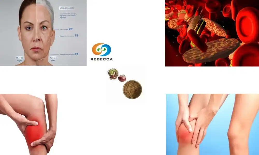 What Makes Horse Chestnut Seed Extract a Popular Herbal Supplement?
